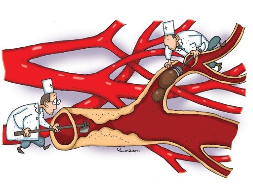 GIẢM MỠ MÁU HIỆU QUẢ VỚI TINH LÁ SEN TƯƠI FIRI (Ảnh minh họa)