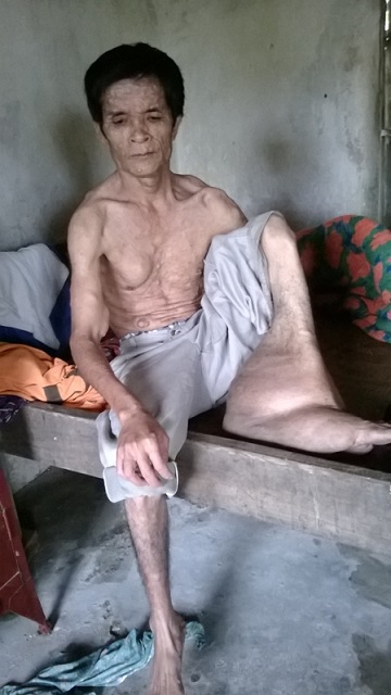 Số phận nghiệt ngã người đàn ông chỉ dám ra ngoài…vào ban đêm