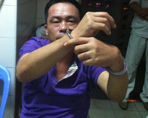 Huế: Bảo vệ bệnh viện vây bắt đối tượng trộm cắp chuyên nghiệp Huế: Bảo vệ bệnh viện vây bắt đối tượng trộm cắp chuyên nghiệp