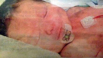 Kỳ diệu, bé gái không có máu trong cơ thể đi học Kỳ diệu, bé gái không có máu trong cơ thể đi học