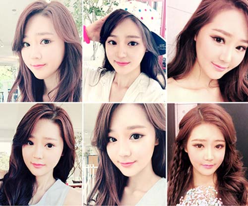 Sau 60 ngày, cô gái hàm bồ nông bỗng xinh như tiên nữ - Ảnh 9. Sau 60 ngày, cô gái hàm bồ nông bỗng xinh như tiên nữ - Ảnh 9.