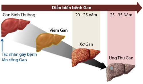 4 việc làm ngay để nuôi dưỡng một lá gan khoẻ mạnh - Ảnh 1. 4 việc làm ngay để nuôi dưỡng một lá gan khoẻ mạnh - Ảnh 1.