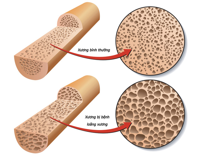7 công thức sức khỏe: Công thức số 1 của chuyên gia kinh tế Mỹ khiến nhiều người tỉnh ngộ! - Ảnh 6. 7 công thức sức khỏe: Công thức số 1 của chuyên gia kinh tế Mỹ khiến nhiều người tỉnh ngộ! - Ảnh 6.