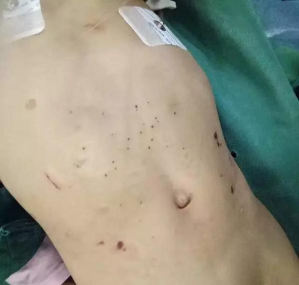 Bé gái 3 tuổi bị bỏng da đầu, kim đâm chi chít ở bụng từ những lần tra tấn dã man của mẹ kế - Ảnh 2.