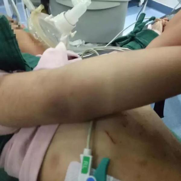 Bé gái 3 tuổi bị bỏng da đầu, kim đâm chi chít ở bụng từ những lần tra tấn dã man của mẹ kế - Ảnh 4.