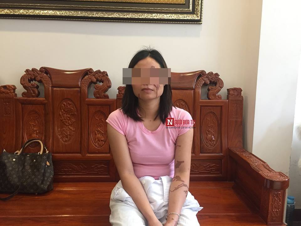 An ninh - Hình sự - 'Nhiễu' thông tin vụ mẹ đơn thân tố bị bác sĩ nha khoa cưỡng dâm bất thành