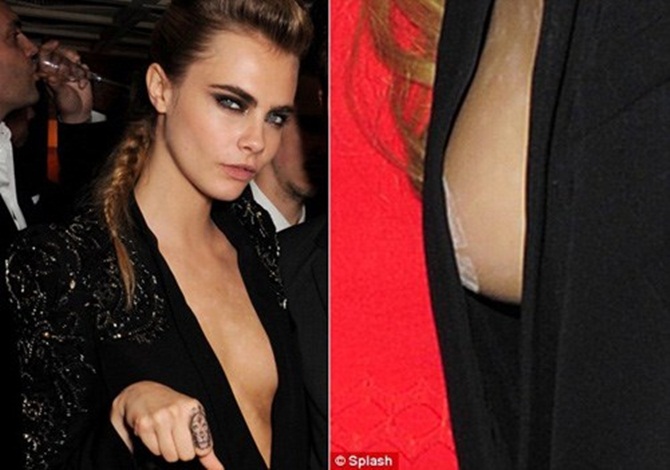 Sao ngoại ngực mướp Sao ngoại ngực mướp