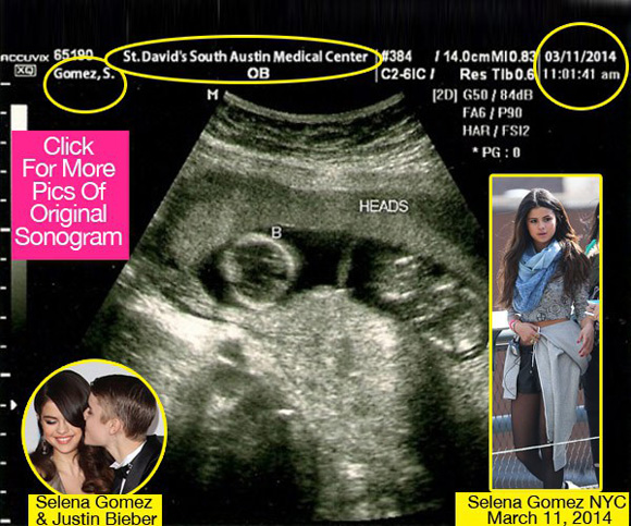 Sốt tin Selena Gomez mang song thai với Justin Bieber