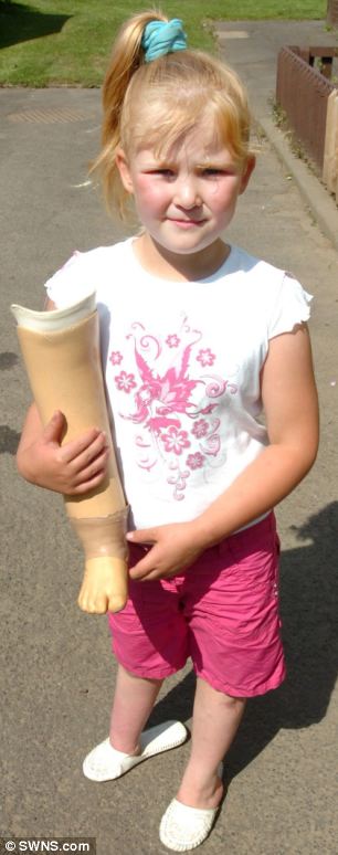 Bé gái 2 tuổi bị cắt cụt chân do y tá chẩn đoán bệnh sai bệnh Bé gái 2 tuổi bị cắt cụt chân do y tá chẩn đoán bệnh sai bệnh