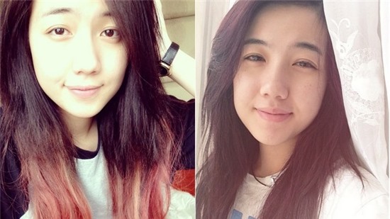 Những khuyết điểm trên cơ thể hot girl Việt