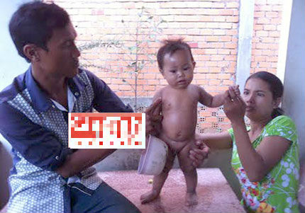 Thực hư lời đồn rắn “trả thù” ám bệnh lạ vào cậu con trai