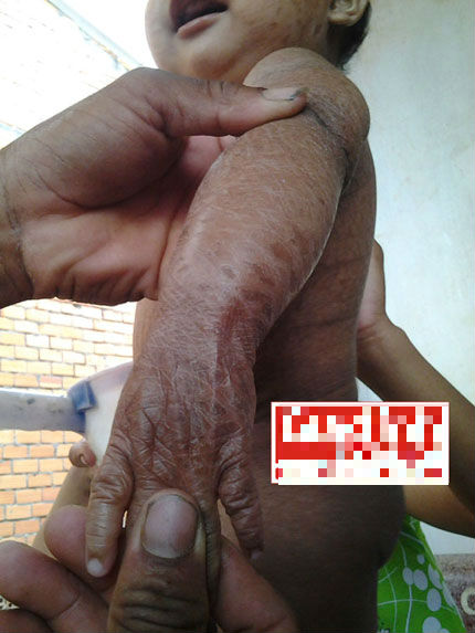 Thực hư lời đồn rắn “trả thù” ám bệnh lạ vào cậu con trai