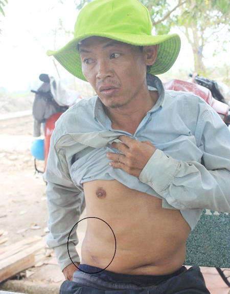 Nhiều người bán thận mất tích kỳ lạ-2