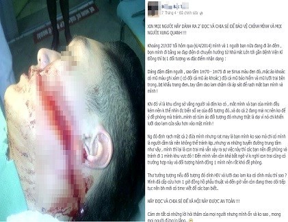 Vén màn bí mật vụ nam sinh bị rạch mặt giữa đường ở Hải Phòng