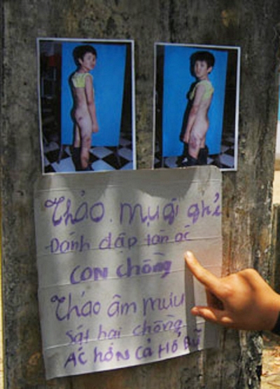 Mẹ kế hành hạ con riêng, chém chồng khâu 50 mũi