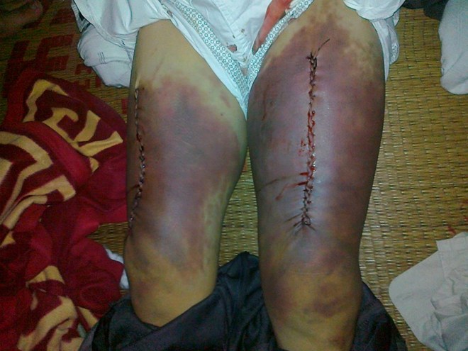 đánh chết nghi pham