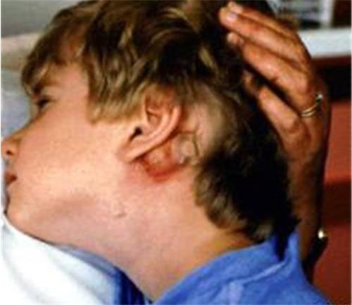 Cảnh báo dịch hạch nguy hiểm có thể xâm nhập Việt Nam Cảnh báo dịch hạch nguy hiểm có thể xâm nhập Việt Nam