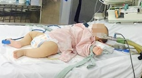 Mẹ vô tình làm con co giật, li bì do ngộ độc chì