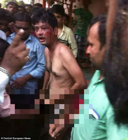 Người đàn ông bị cắt 