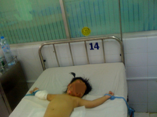 Cần khởi tố vụ án ném “bom xăng” vào nhà Trưởng công an xã