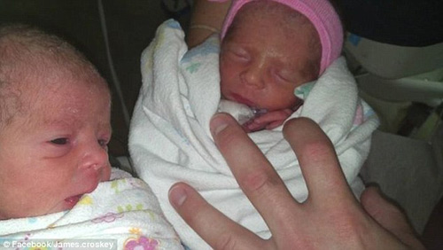 Kỳ lạ: Tưởng đau dạ dày lại hóa đẻ đôi