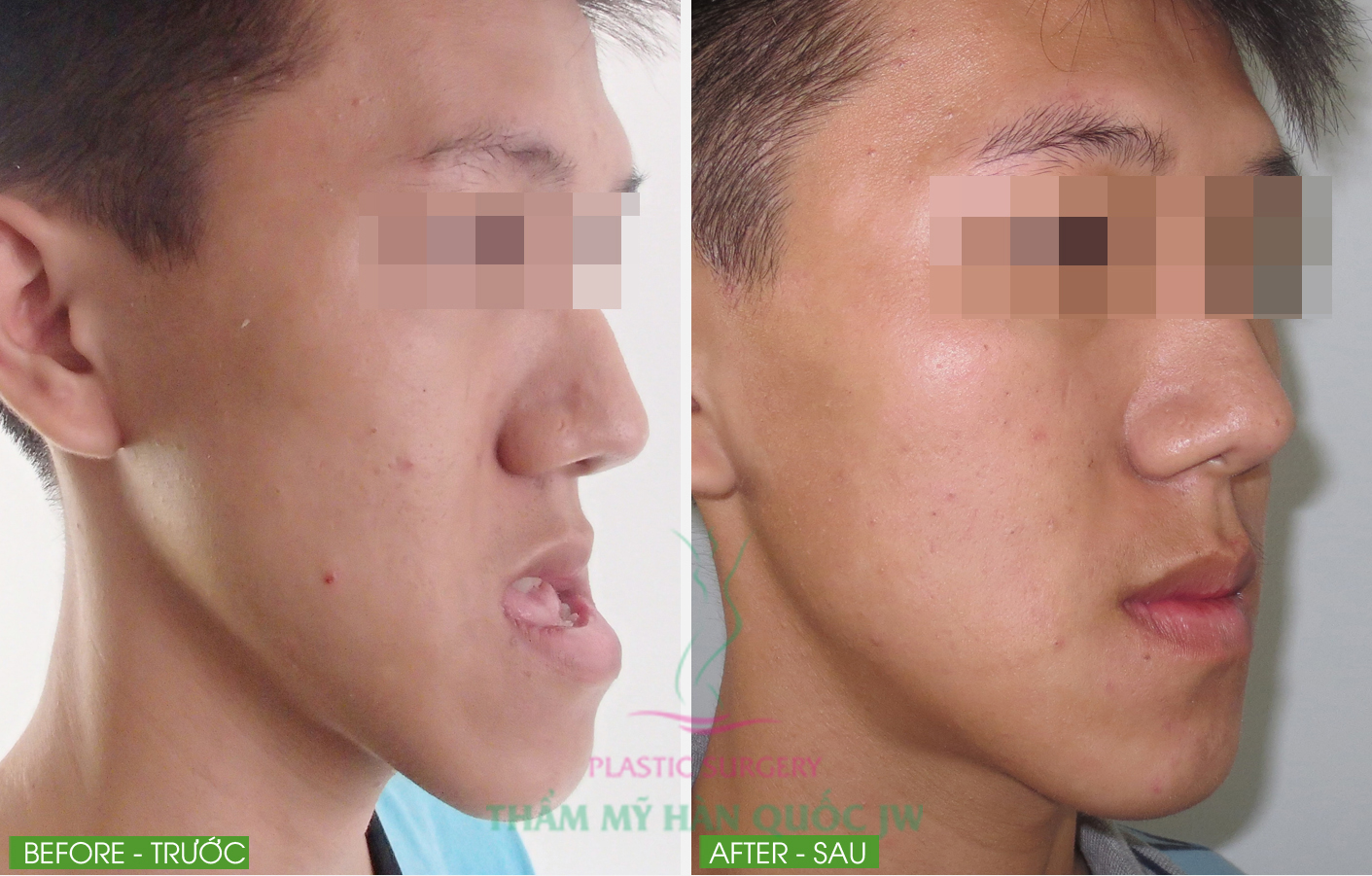 Bệnh viện thẩm mỹ Hàn Quốc Yeong Won - nơi giúp bạn thay đổi