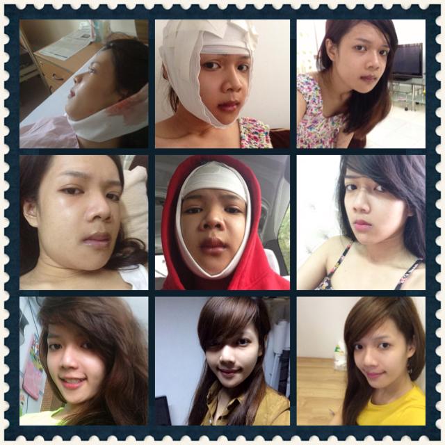 Hành trình “lột xác” thành thiên nga của cô gái bé nhỏ Minh Yến