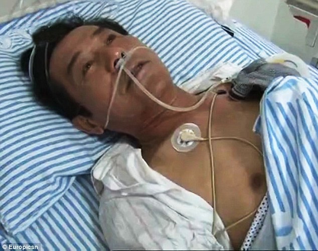 Bị đau lưng hàng chục năm vì kim châm “trú ngụ” trong dạ dày