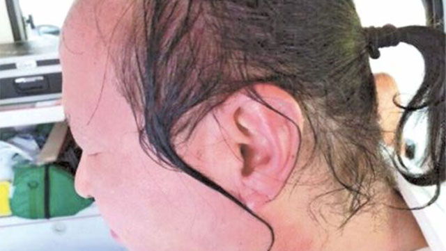 Bị mắng, nữ sinh hất nước nóng vào mặt giảng viên