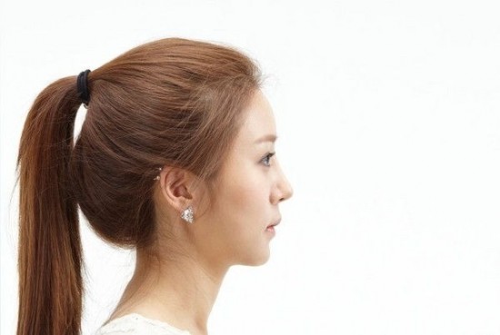 Kinh ngạc nhan sắc của chị em song sinh sau phẫu thuật thẩm mỹ