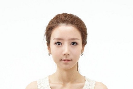 Kinh ngạc nhan sắc của chị em song sinh sau phẫu thuật thẩm mỹ