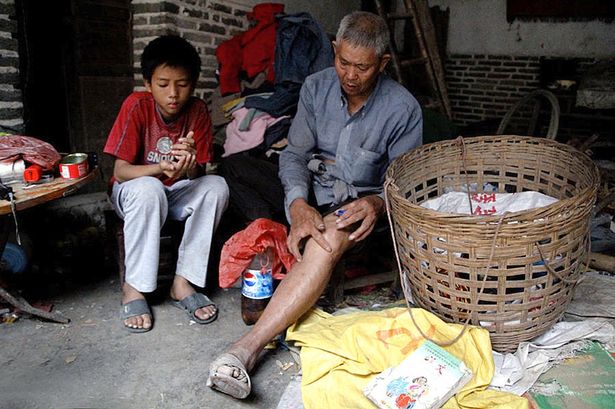 Chuyện đời buồn của người đàn ông 12 năm phải nhốt vợ trong “tù”