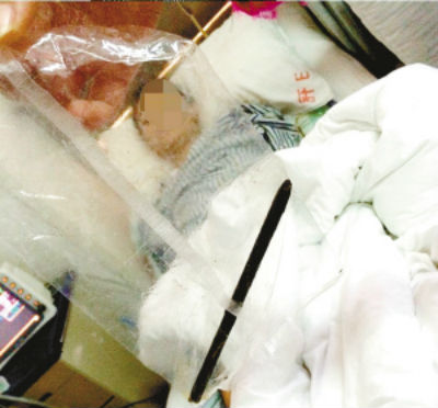 Chàng trai nuốt chửng bút chì dài 17 cm vì cãi nhau với cha