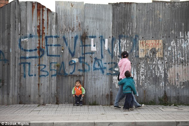 Chàng trai 28 tuổi chỉ cao gần 70 cm 