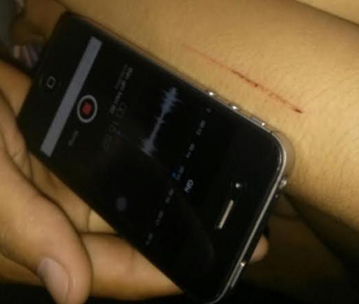 Những vụ dùng dao rạch phụ nữ rúng động dư luận Khánh Hòa