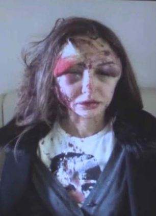 Triệu phú Nga đánh bạn gái “thập tử nhất sinh”