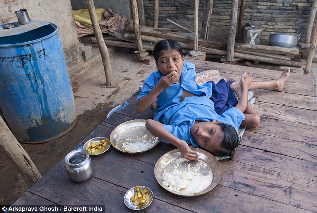 Cuộc sống thường nhật của hai bé trai song sinh dính liền Cuộc sống thường nhật của hai bé trai song sinh dính liền