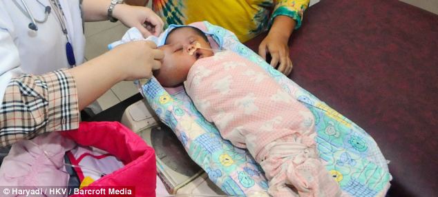  Kỳ lạ bé sơ sinh mang khuôn mặt hình trái tim