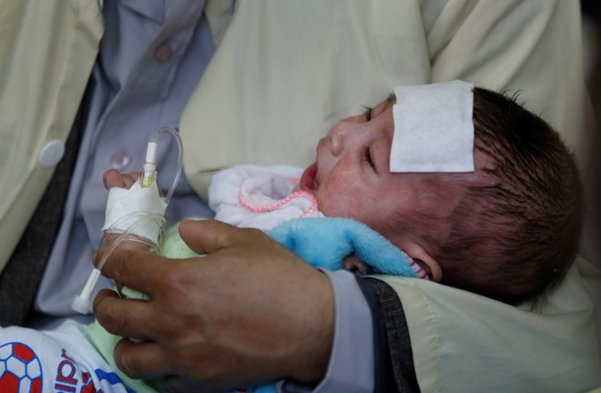 Dịch sởi nặng nhất trong hàng thập kỷ ở Việt Nam