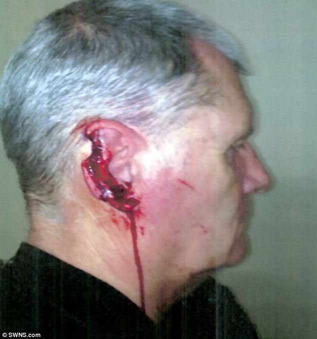 Lãnh án 8 năm tù vì dám cắn đứt tai cảnh sát