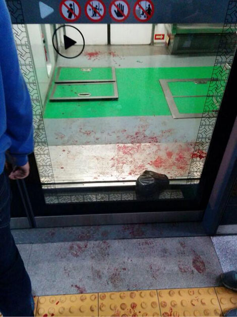 Hàn Quốc: Hai tàu điện ngầm đâm nhau, 170 người bị thương Hàn Quốc: Hai tàu điện ngầm đâm nhau, 170 người bị thương