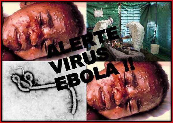 Đại dịch Ebola bắt nguồn từ bé 2 tuổi