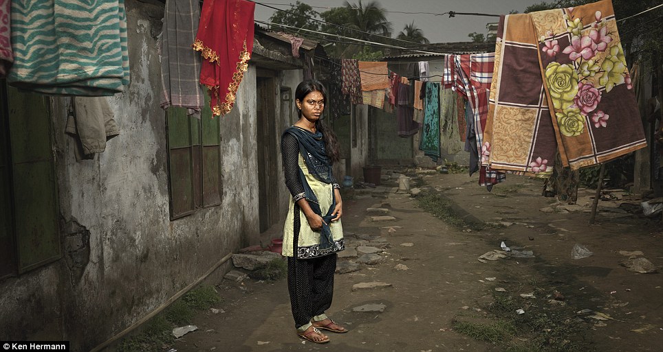 Những khuôn mặt biến dạng kinh hoàng vì axit