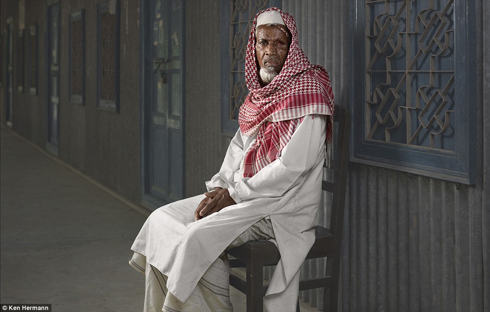 Những khuôn mặt biến dạng kinh hoàng vì axit