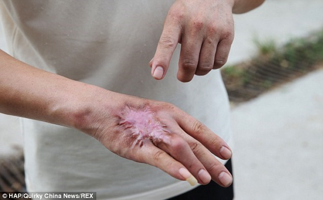 Bị cắn nhiều lần nhưng vẫn quyết nuôi 30.000 con rắn hổ mang