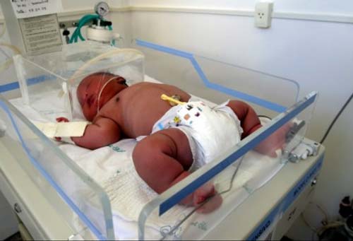 Những bé sơ sinh “khổng lồ” trên thế giới Những bé sơ sinh “khổng lồ” trên thế giới