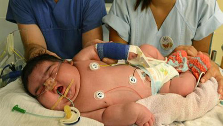 Những bé sơ sinh “khổng lồ” trên thế giới Những bé sơ sinh “khổng lồ” trên thế giới
