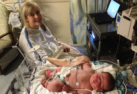 Những bé sơ sinh “khổng lồ” trên thế giới Những bé sơ sinh “khổng lồ” trên thế giới