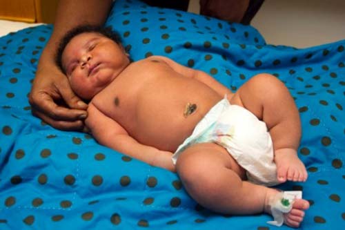 Những bé sơ sinh “khổng lồ” trên thế giới Những bé sơ sinh “khổng lồ” trên thế giới
