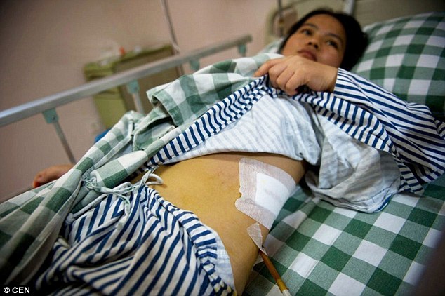 Chấn động: Bệnh viện TQ bị “tố” đánh cắp thận của bệnh nhân